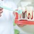 Implanty zębów a wpływ na codzienne funkcjonowanie
